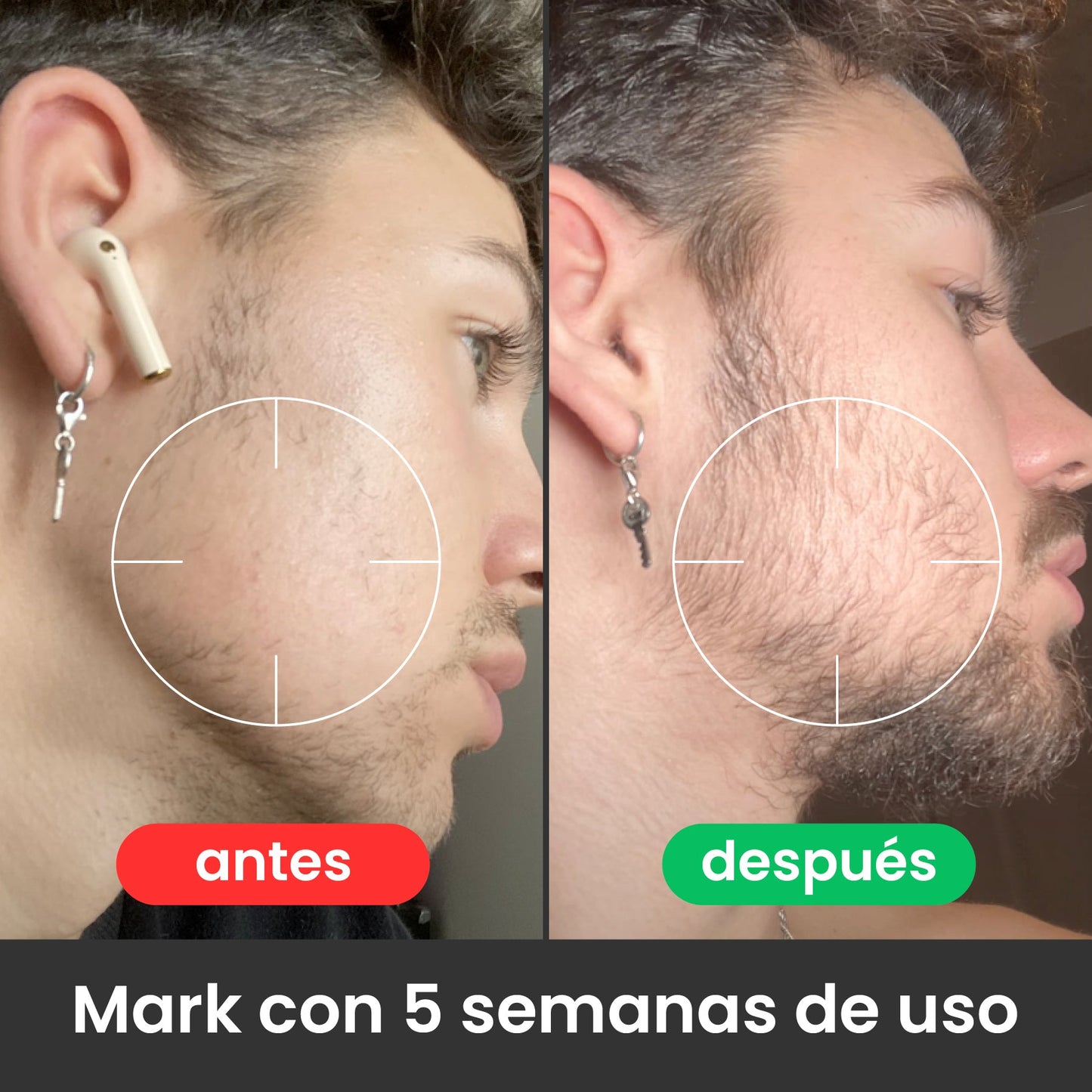 LLEVA 2X POR SUPER PRECIO Bálsamo para Crecimiento de Barba Ultra Potente con Minoxidil 20% | 100mL